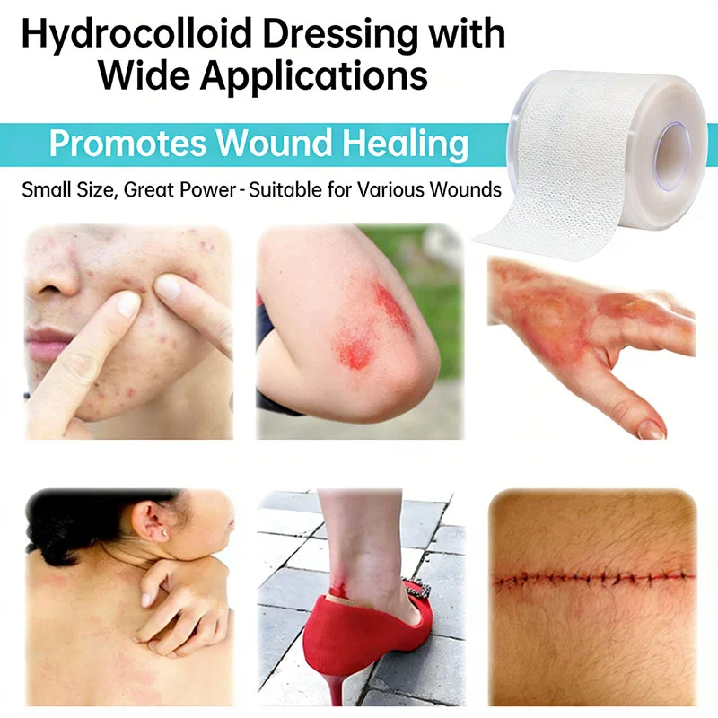 Bordered Hydrocolloid Dressing Roll With Pull Tab For Burn Care